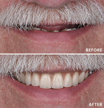 Before After Image