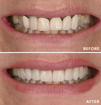 Before After Image