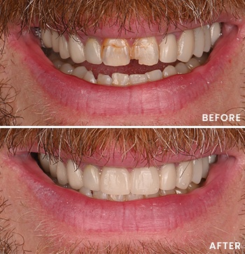 Before After Image