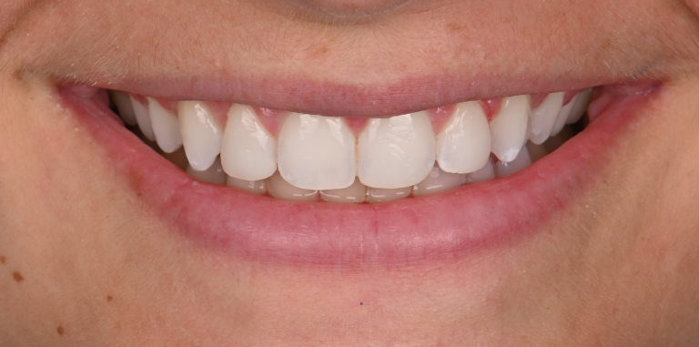 After Image