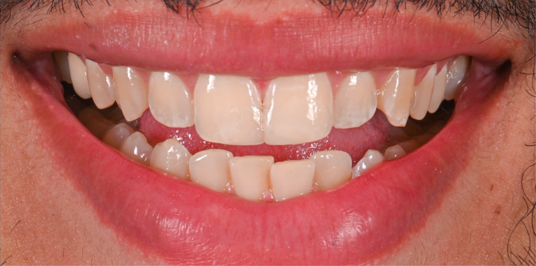 After Image
