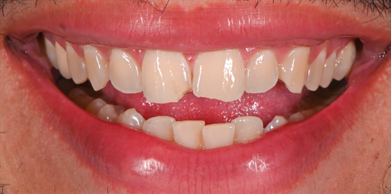 Before Image