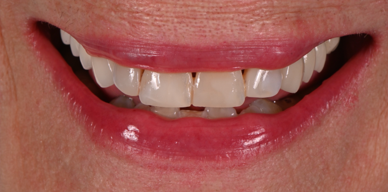 After Image