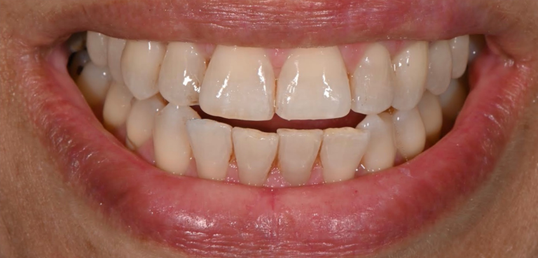 After Image
