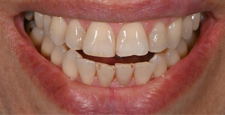 Before Image