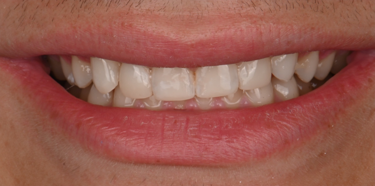 After Image