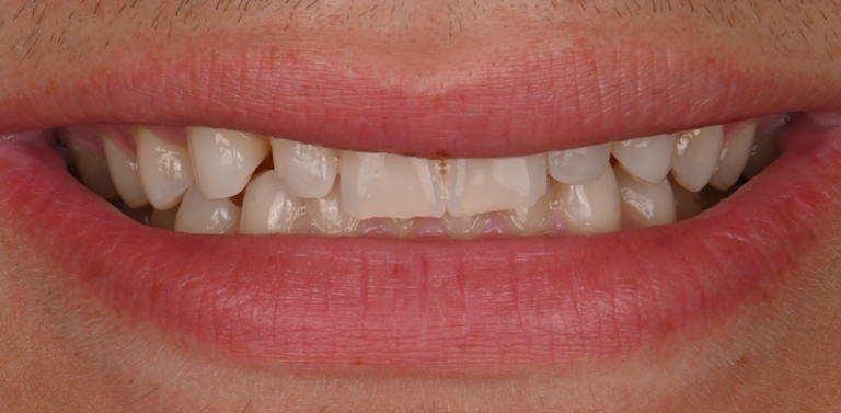Before Image
