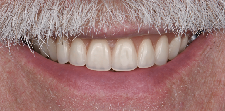 After Image