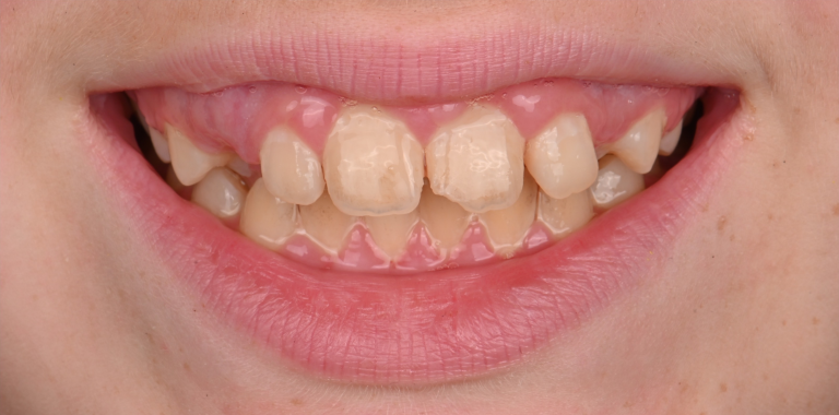 Before Image
