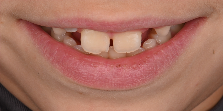 Before Image