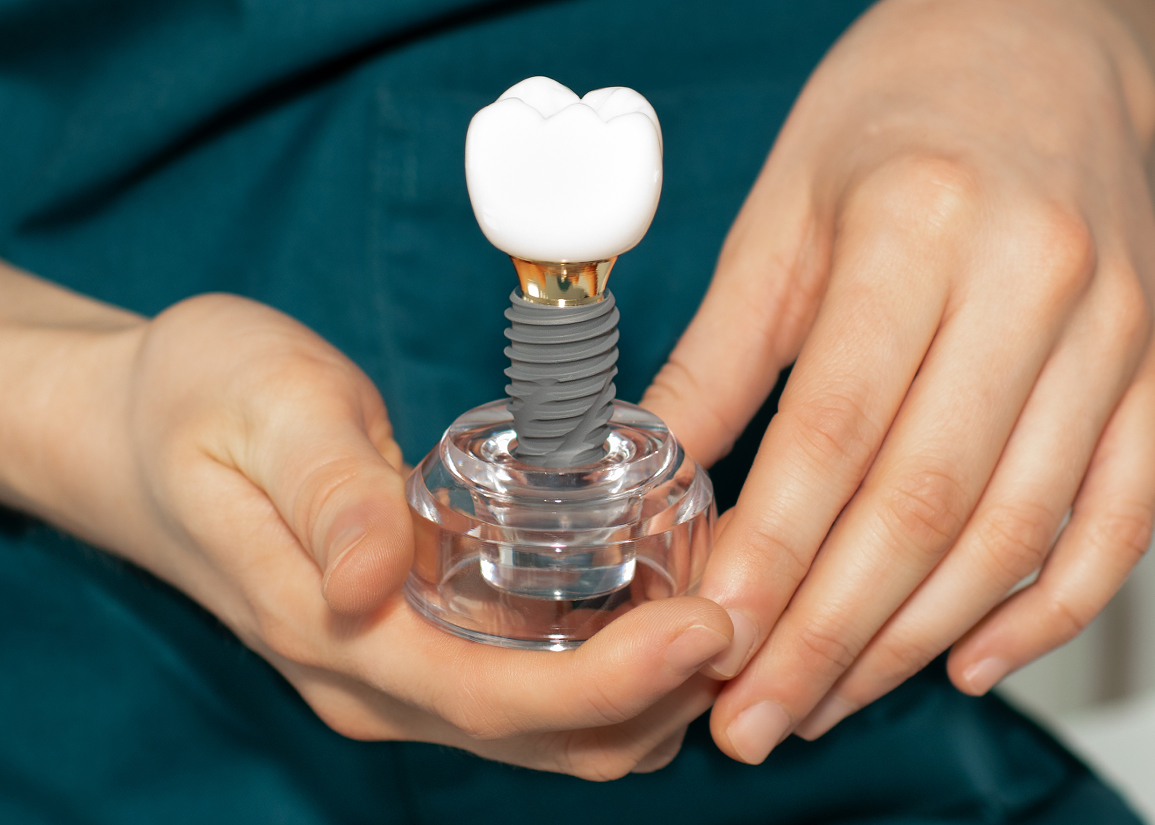 How to maintain implant restorations