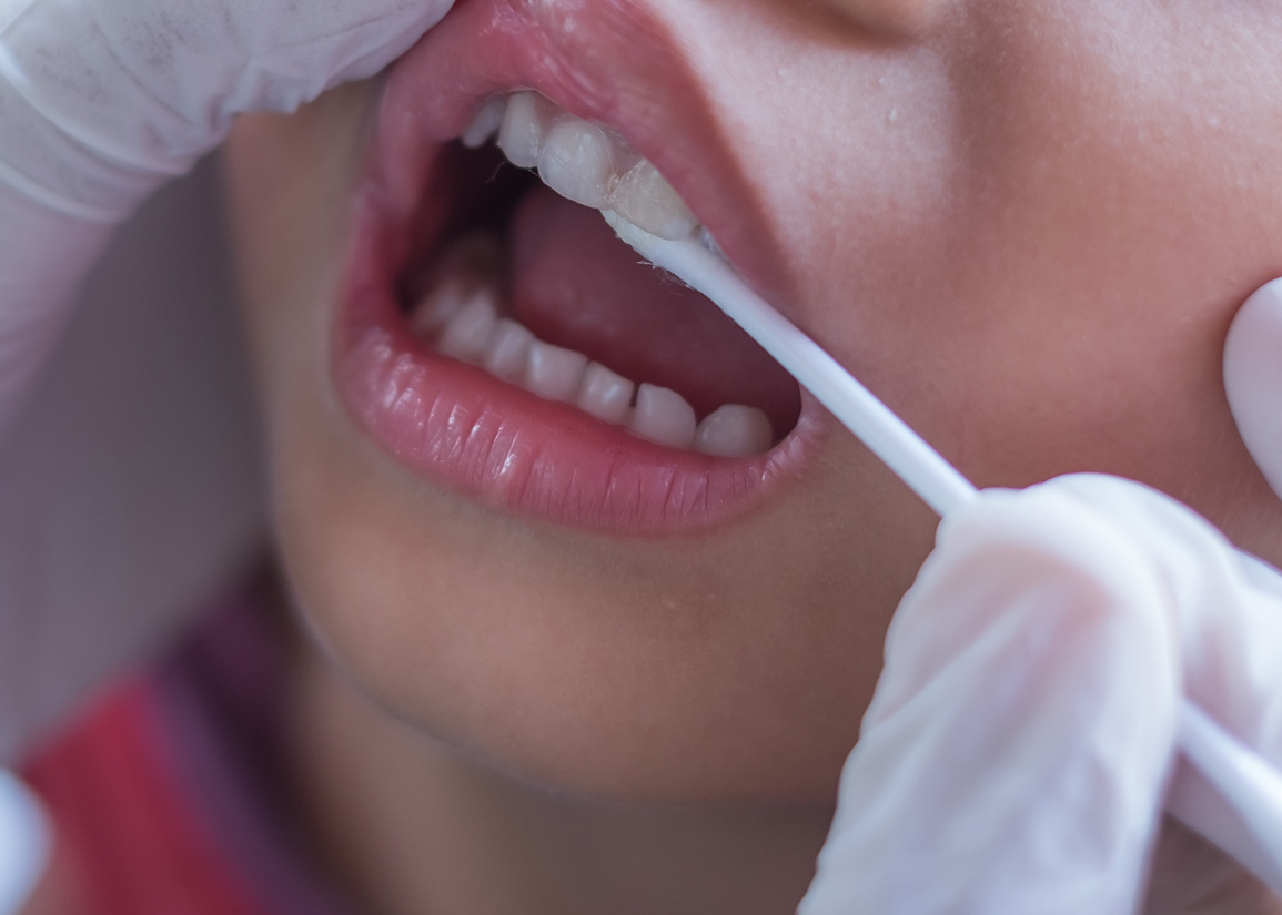 Fluoride treatment during dental visit