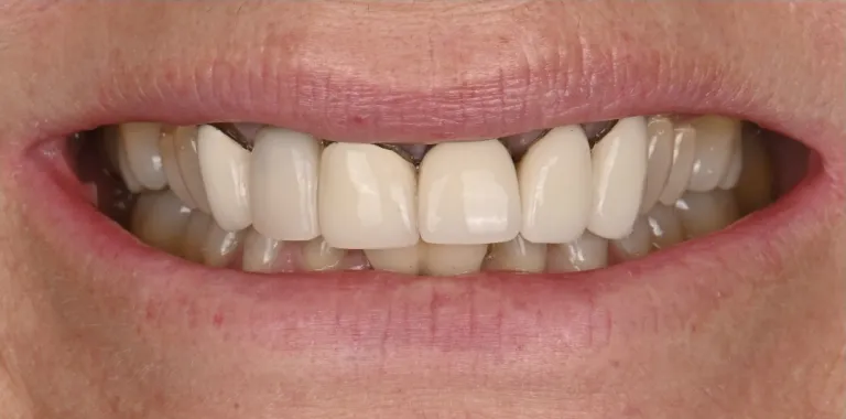 Before Image