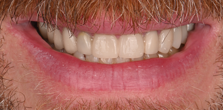 After Image