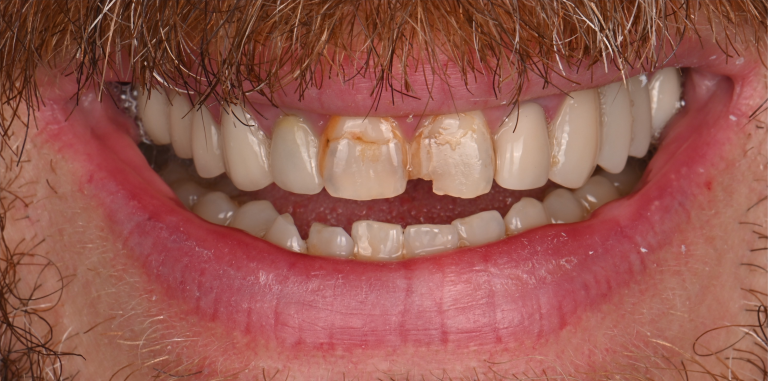 Before Image