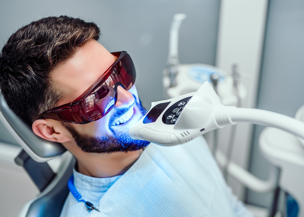 Common causes of tooth discoloration