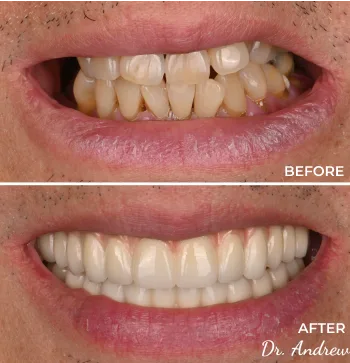 Before After Image