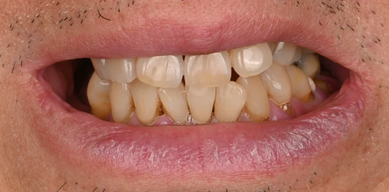 Before Image